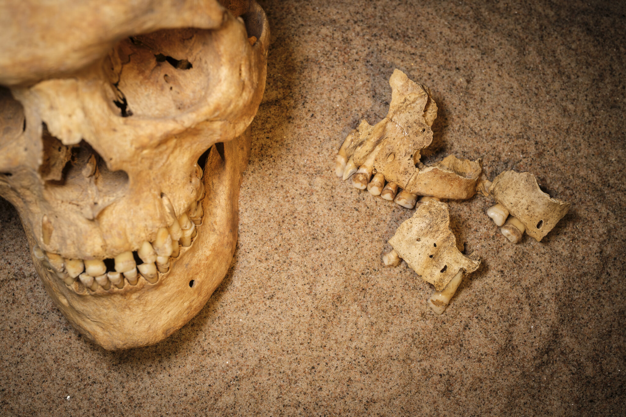 Remains of a Viking Age skull and teeth displayed on sand.